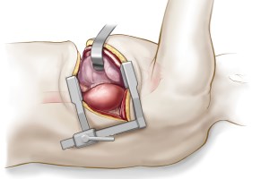 The Prevention and Treatment of Cardiovascular Diseases